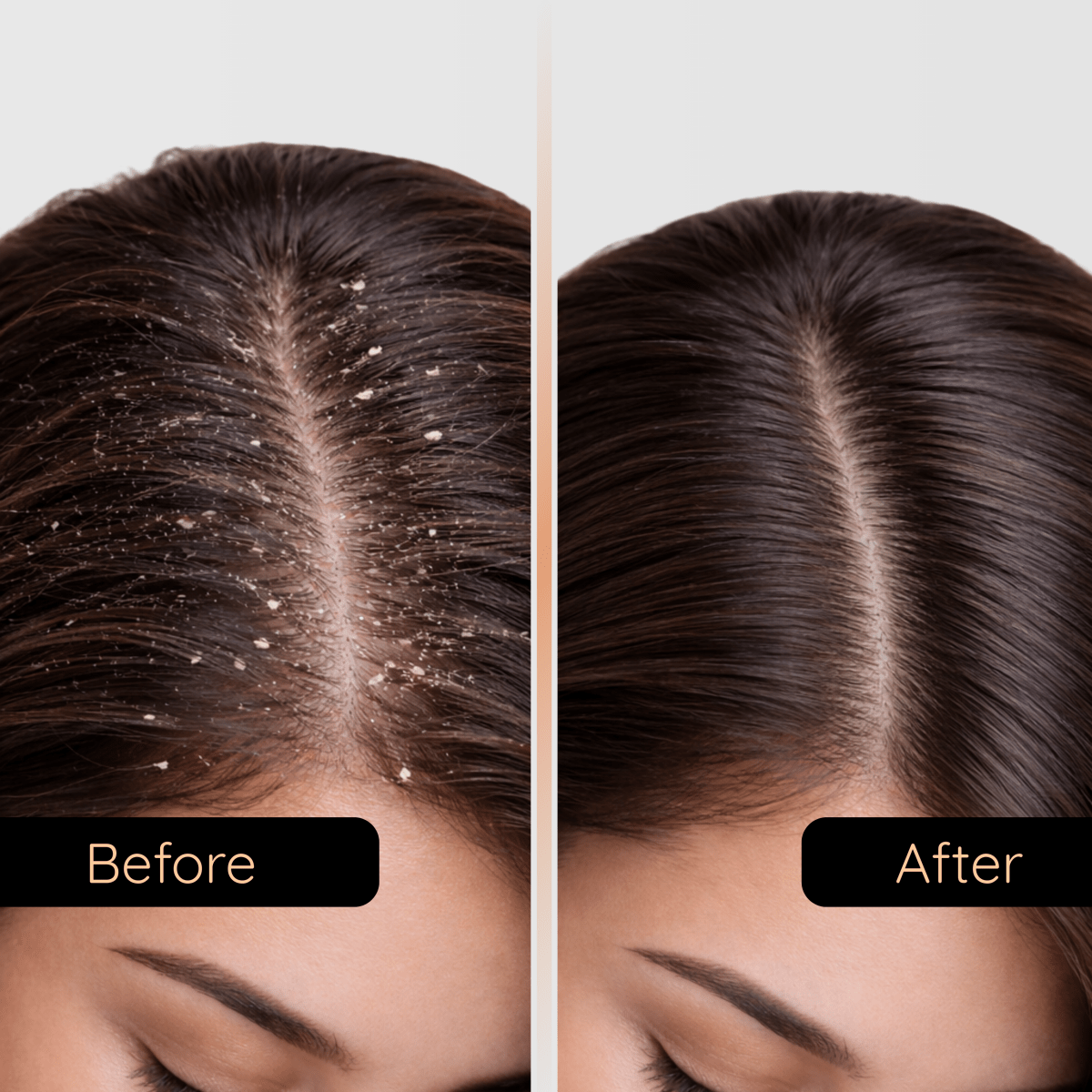 Black Soil Shampoo - Control Dandruff & Hair Repair