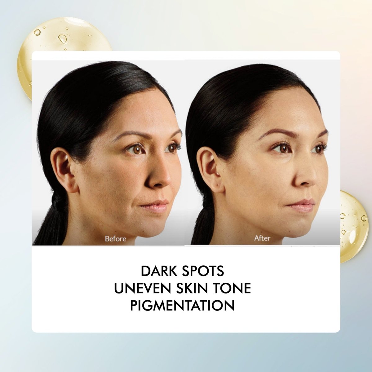 InstaCare 20% Vitamin C Serum