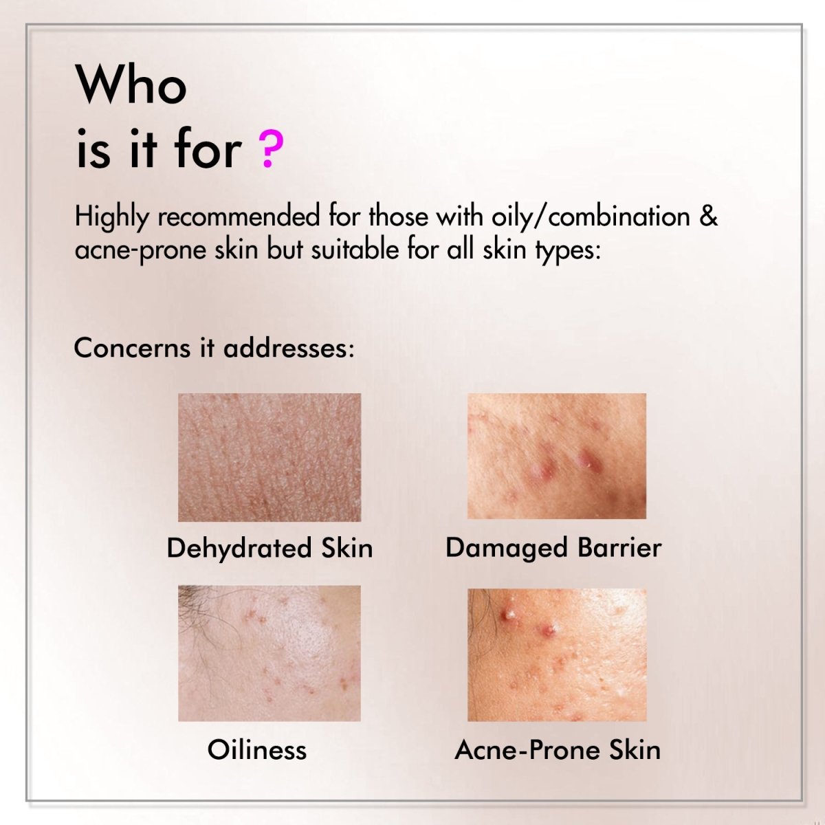 Argireline + Squalene Anti Ageing Serum